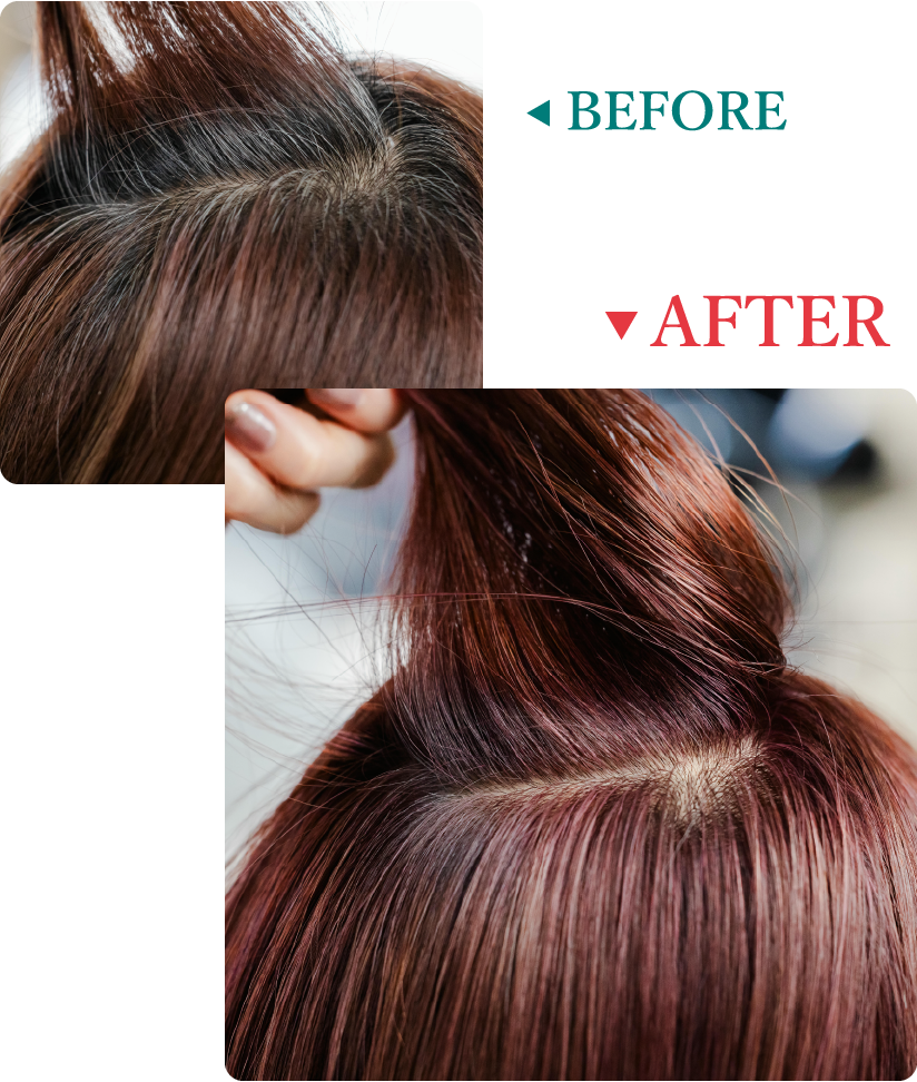 BEFORE - AFTER